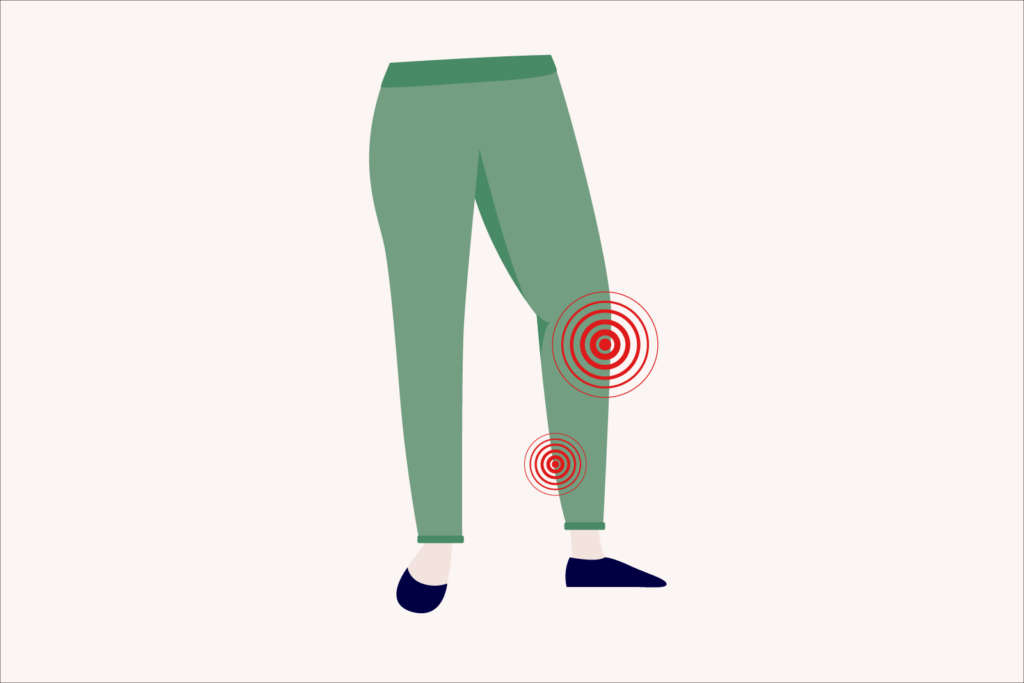 Best Sleeping Position For Peripheral Artery Disease (2024)