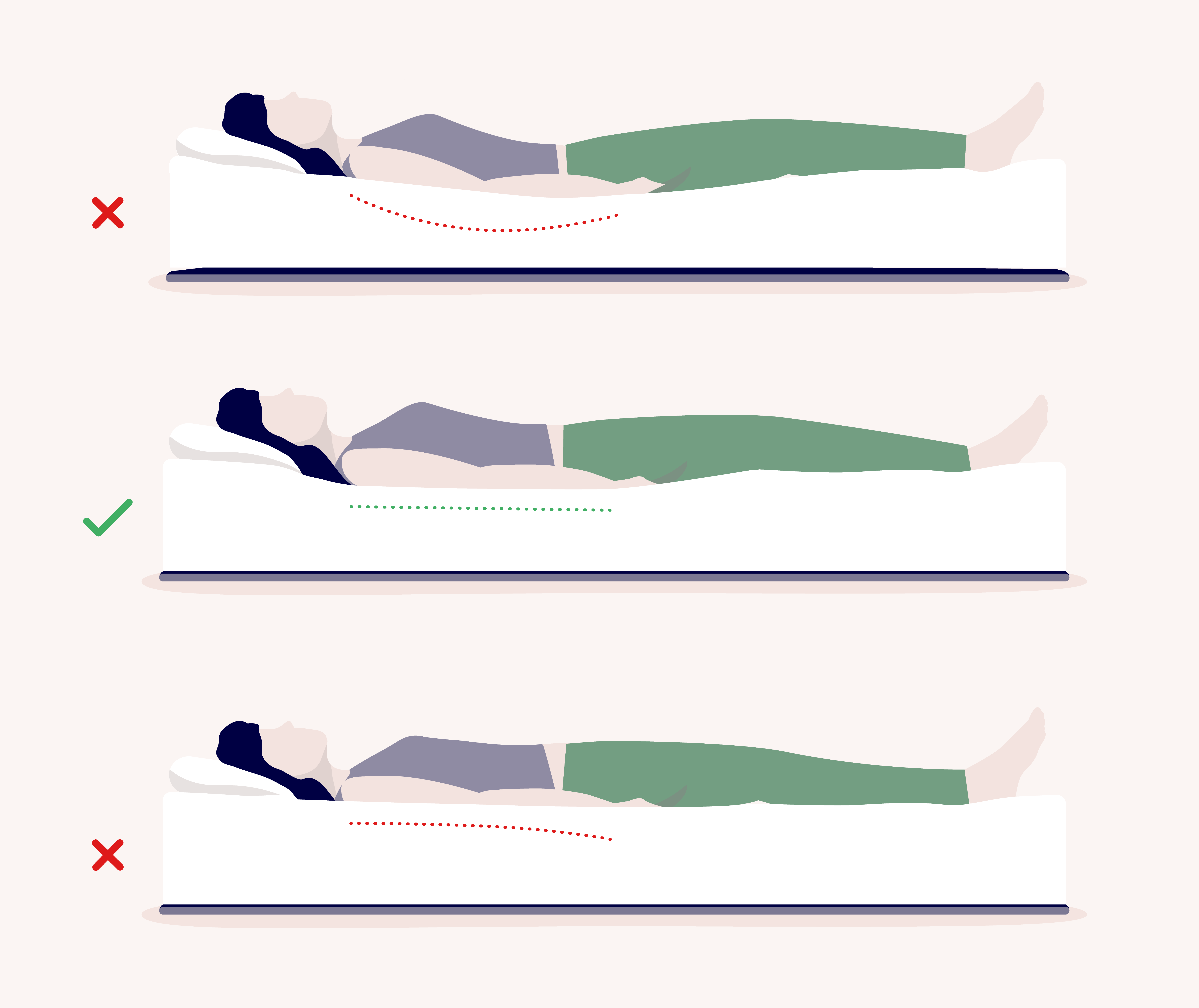 three way split visual of a person sleeping on their back on beds with different firmnesses A soft mattress where the person's back is not supported, a medium-firm mattress where the spine and neck are properly aligned, and a firm mattress where there isn't enough body contouring leading to pain