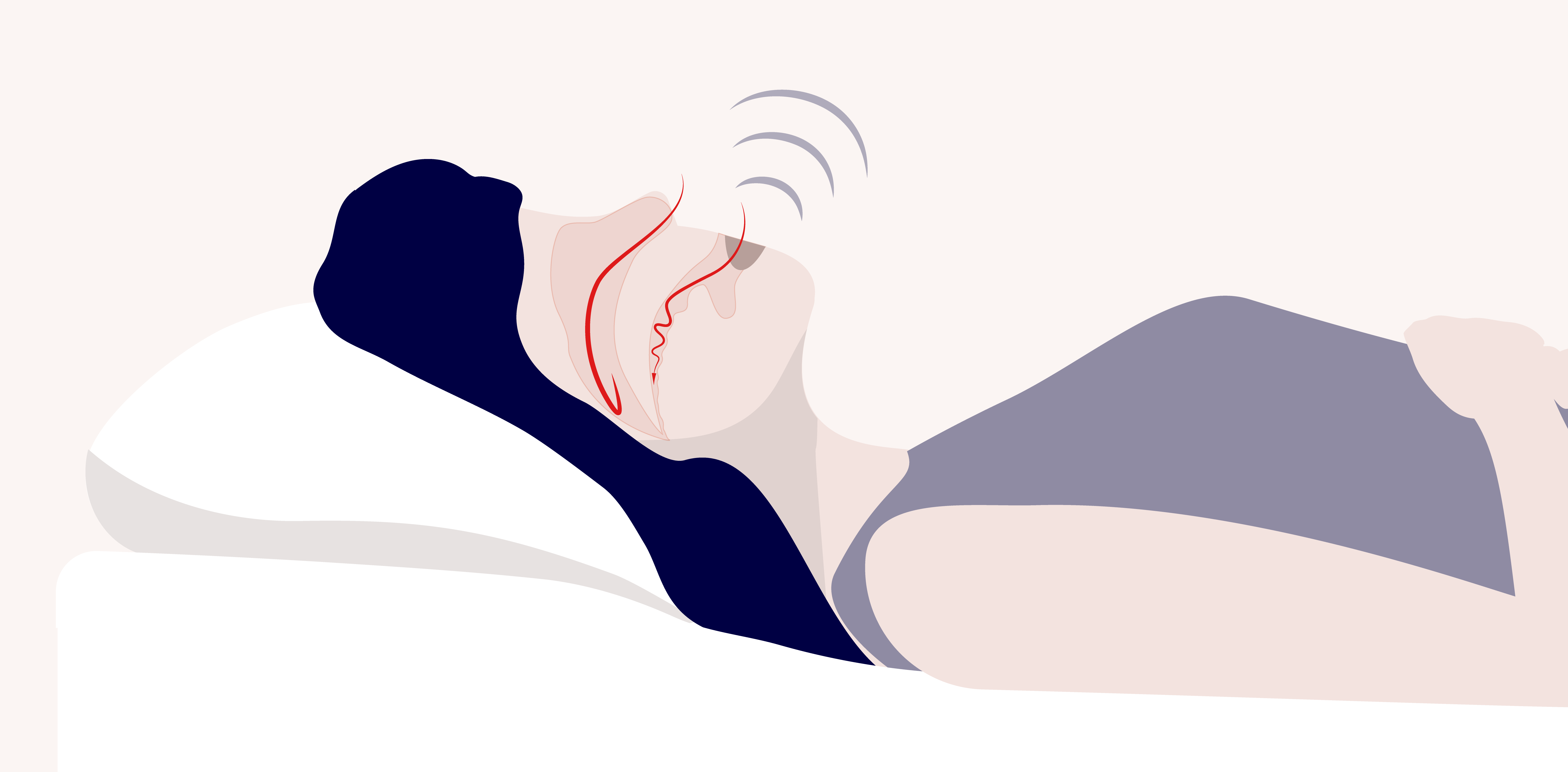illustration of a person sleeping on their back and snoring