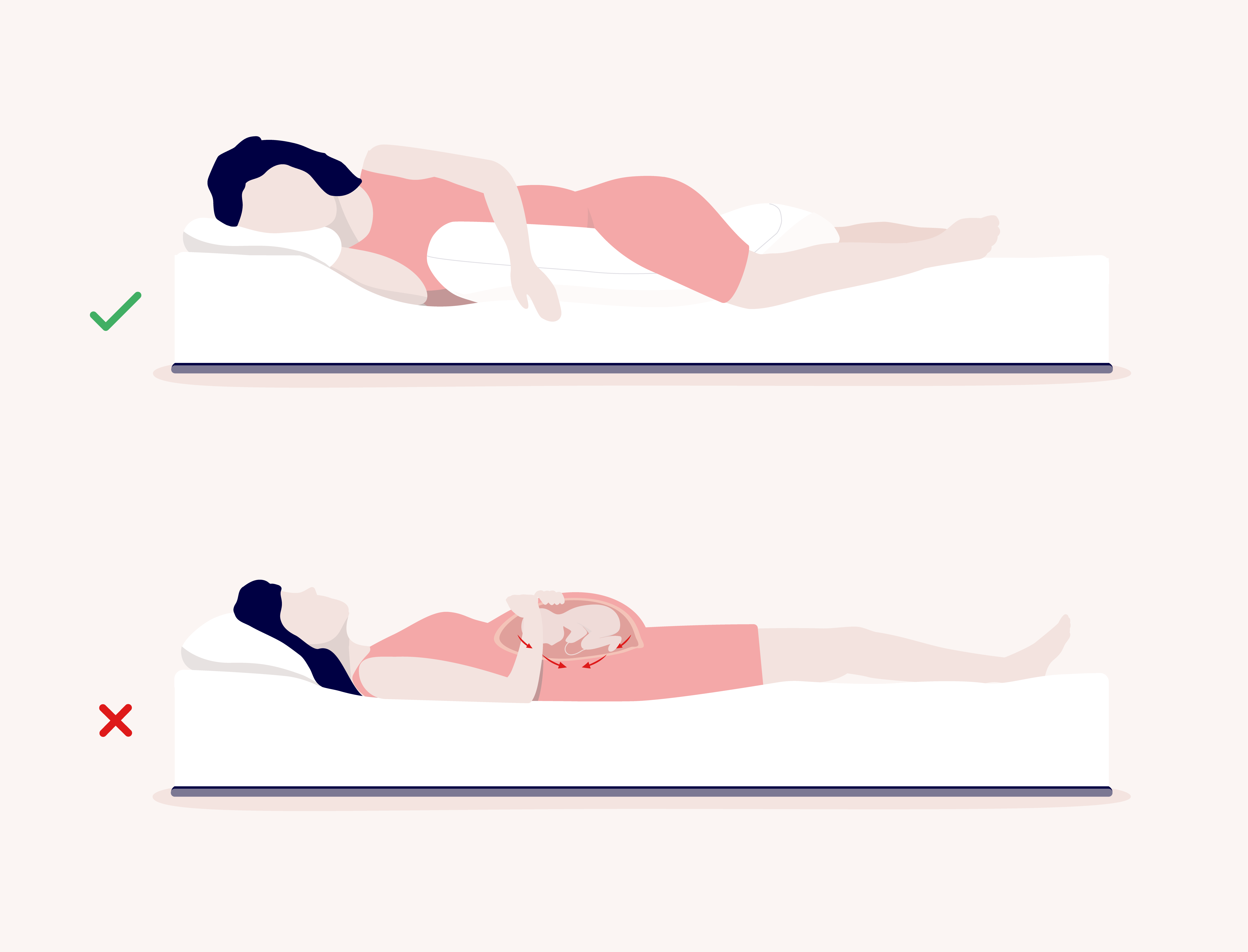 a split illustration of a pregnant person lying on their side with a pregnancy pillow vs sleeping on their back showing uterus pressure when lying on back